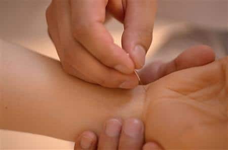 Acupuncture for Repetitive Strain Injuries (RSI)